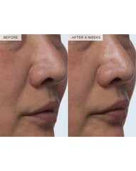 Watermelon Glow PHA+BHA Pore-Tight Toner, 150ml