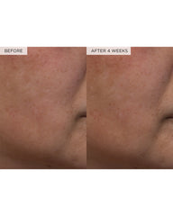 Watermelon Glow PHA+BHA Pore-Tight Toner, 150ml